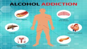 The effect of alcohol on the nervous system and its damage