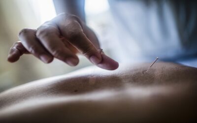 The benefits and harms of acupuncture