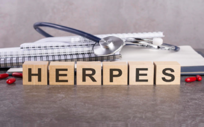 Treatment for genital herpes