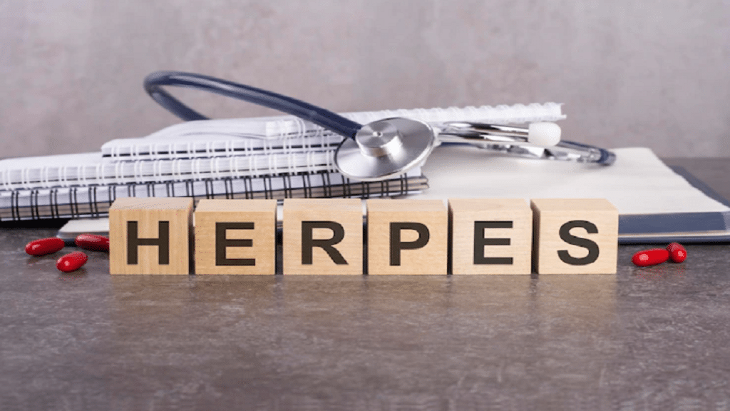 Treatment for genital herpes