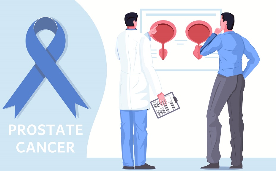 Prostate Treatment for Cancer